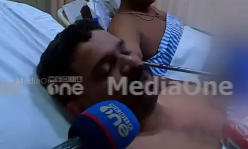 ദേഹത്ത് ടാറൊഴിച്ച് പൊള്ളിച്ചു; യാത്രക്കാർക്ക് ടാറിങ് തൊഴിലാളികളുടെ മർദനം ദേഹത്ത് ടാറൊഴിച്ച് പൊള്ളിച്ചു; യാത്രക്കാർക്ക് ടാറിങ് തൊഴിലാളികളുടെ മർദനം