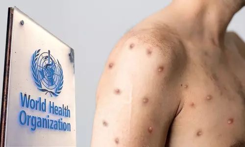 കുരങ്ങുവസൂരിയുടെ പുതിയ പേര് ട്രംപ്-22; പരിഹാസ്യമായി ഒന്നുമില്ല, ജനം ആഗ്രഹിക്കുന്നതായി ലോകാരോഗ്യ സംഘടന