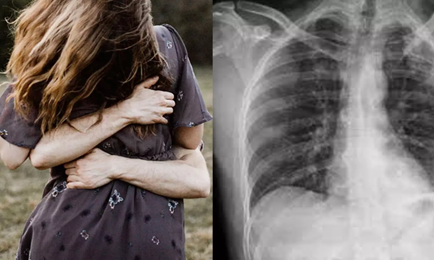 സ്നേഹപ്രകടനം കടുത്തു : സഹപ്രവര്ത്തകന്റെ ആലിംഗനത്തില് വാരിയെല്ലൊടിഞ്ഞ് യുവതി സ്നേഹപ്രകടനം കടുത്തു : സഹപ്രവര്ത്തകന്റെ ആലിംഗനത്തില് വാരിയെല്ലൊടിഞ്ഞ് യുവതി