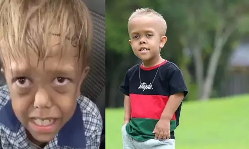 സഹപാഠികളുടെ പരിഹാസം സഹിക്കാനാവാതെ പൊട്ടിക്കരഞ്ഞ ക്വാഡന്‍ ഇനി ഹോളിവുഡില്‍