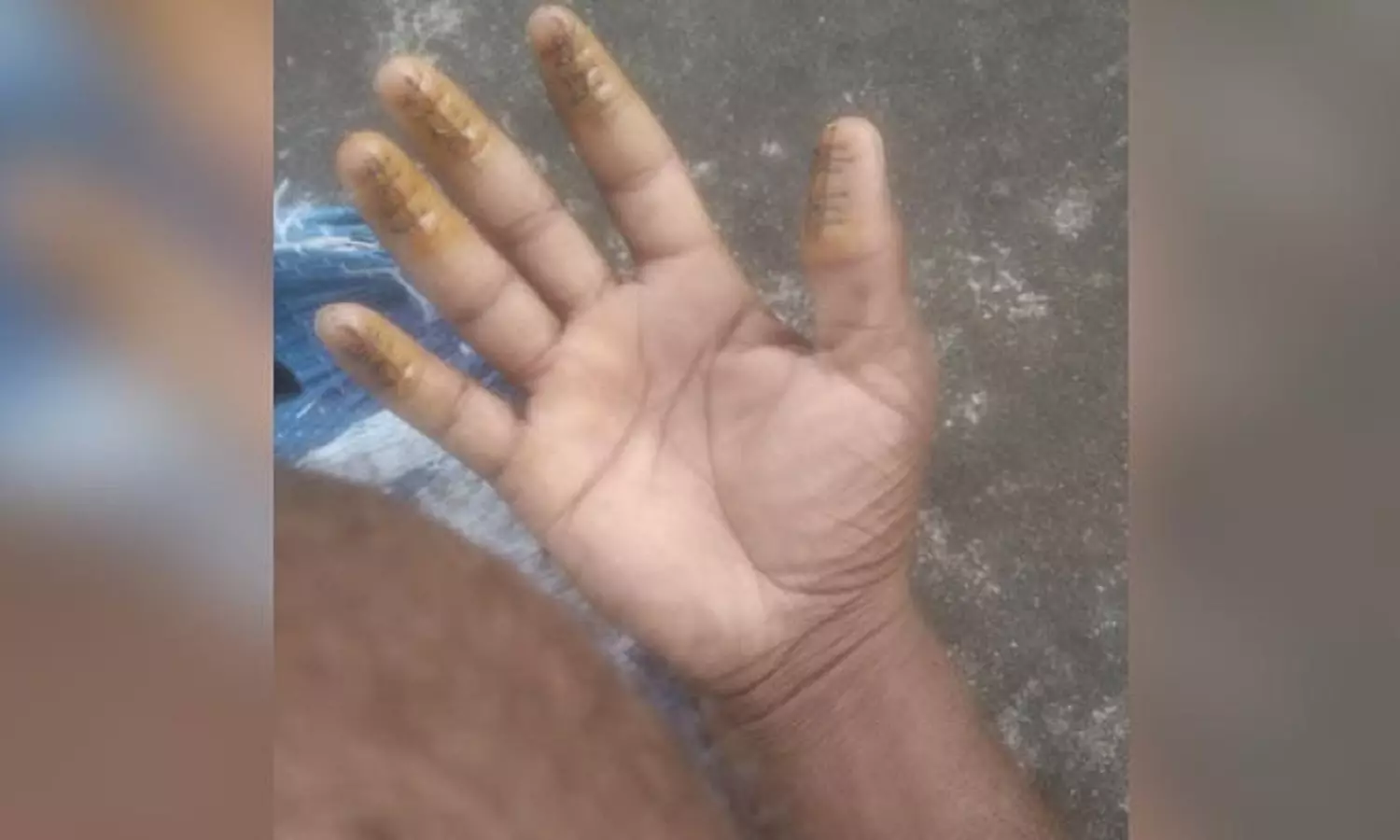 25000 രൂപക്ക് വിരലടയാളം മാറ്റി, കുവൈത്തിലേക്ക് കടക്കാൻ ശ്രമം 25000 രൂപക്ക് വിരലടയാളം മാറ്റി, കുവൈത്തിലേക്ക് കടക്കാൻ ശ്രമം