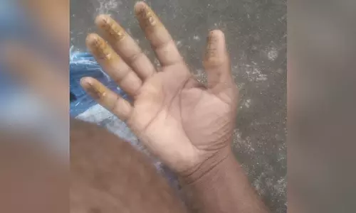 25000 രൂപക്ക് വിരലടയാളം മാറ്റി, കുവൈത്തിലേക്ക് കടക്കാൻ ശ്രമം