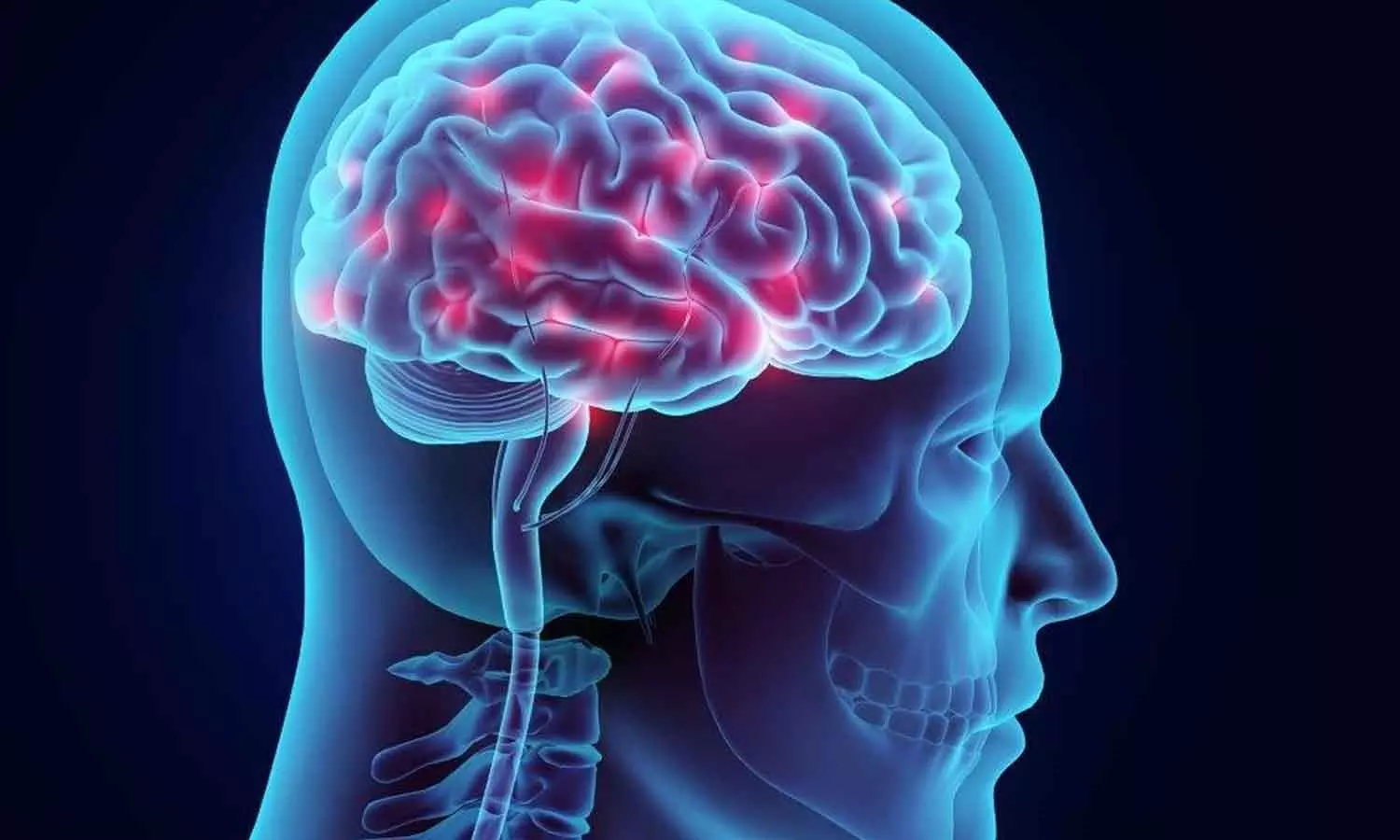 നിശബ്ദമായി കൊല്ലുന്ന മസ്തിഷ്‌കാഘാതം; ശ്രദ്ധിക്കണം ഈ ലക്ഷണങ്ങൾ