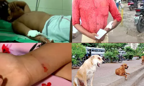 വീണ്ടും തെരുവുനായ ആക്രമണം; കോഴിക്കോട് രണ്ട് കുട്ടികൾ ഉൾപ്പെടെ മൂന്ന് പേരെ കടിച്ചു
