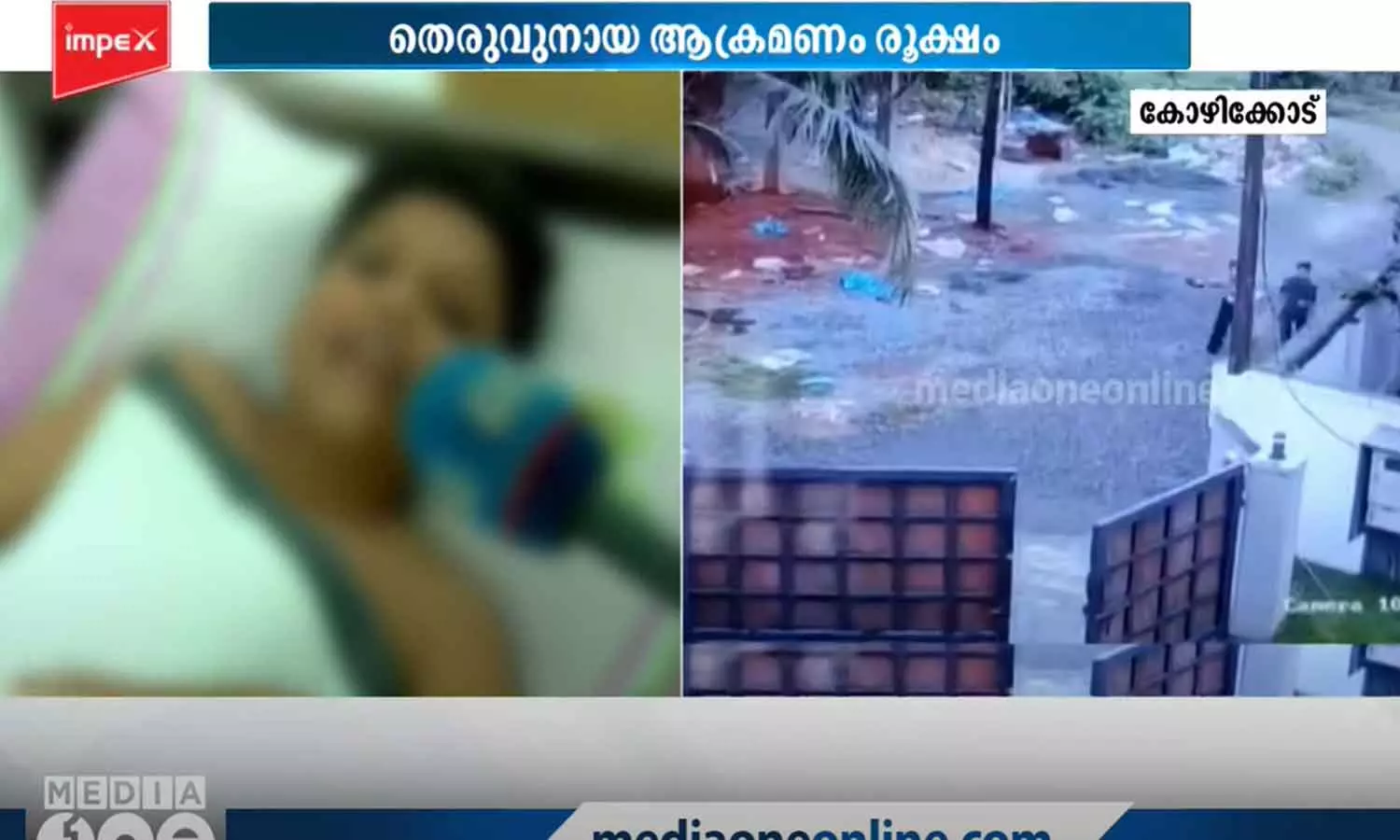 നായ കയ്യിൽ കടിച്ചുപിടിക്കുകയായിരുന്നു, സൈക്കിൾ എന്റെ മേത്തായിപോയി, എണീക്കാൻ കയിഞ്ഞീല-നായ കടിച്ച കുട്ടിയുടെ പ്രതികരണം നായ കയ്യിൽ കടിച്ചുപിടിക്കുകയായിരുന്നു, സൈക്കിൾ എന്റെ മേത്തായിപോയി, എണീക്കാൻ കയിഞ്ഞീല-നായ കടിച്ച കുട്ടിയുടെ പ്രതികരണം