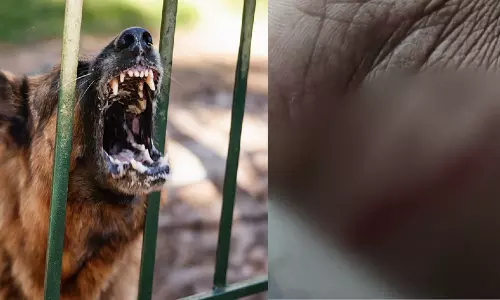 വാക്സിനേഷനിടെ ലൈഫ് സ്റ്റോക് ഇൻസ്പെക്ടർക്ക് വളർത്തുനായയുടെ കടിയേറ്റു വാക്സിനേഷനിടെ ലൈഫ് സ്റ്റോക് ഇൻസ്പെക്ടർക്ക് വളർത്തുനായയുടെ കടിയേറ്റു