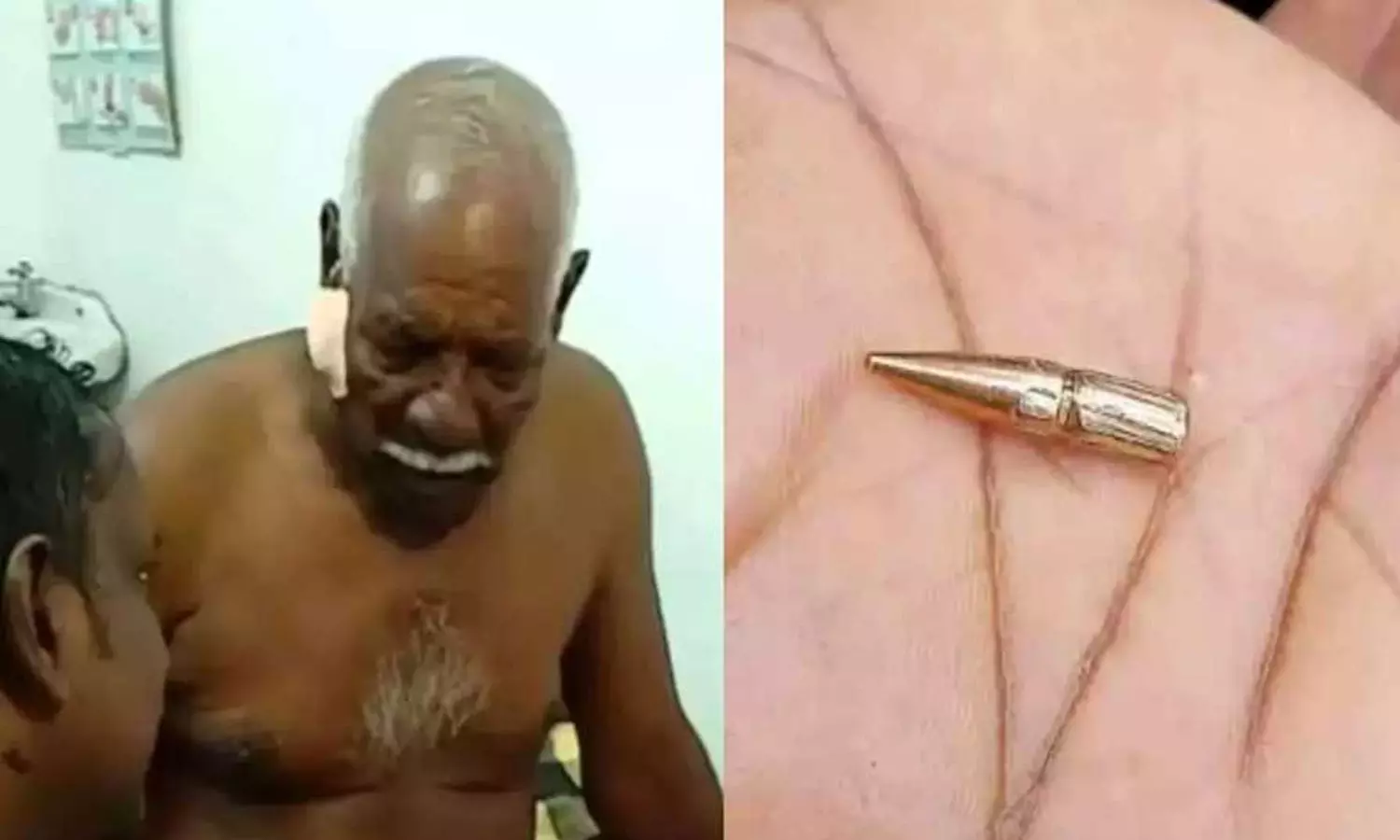 മത്സ്യത്തൊഴിലാളിക്ക് വെടിയേറ്റ സംഭവം; ബാലിസ്റ്റിക് പരിശോധനാ ഫലം കാത്ത് പൊലീസ് മത്സ്യത്തൊഴിലാളിക്ക് വെടിയേറ്റ സംഭവം; ബാലിസ്റ്റിക് പരിശോധനാ ഫലം കാത്ത് പൊലീസ്