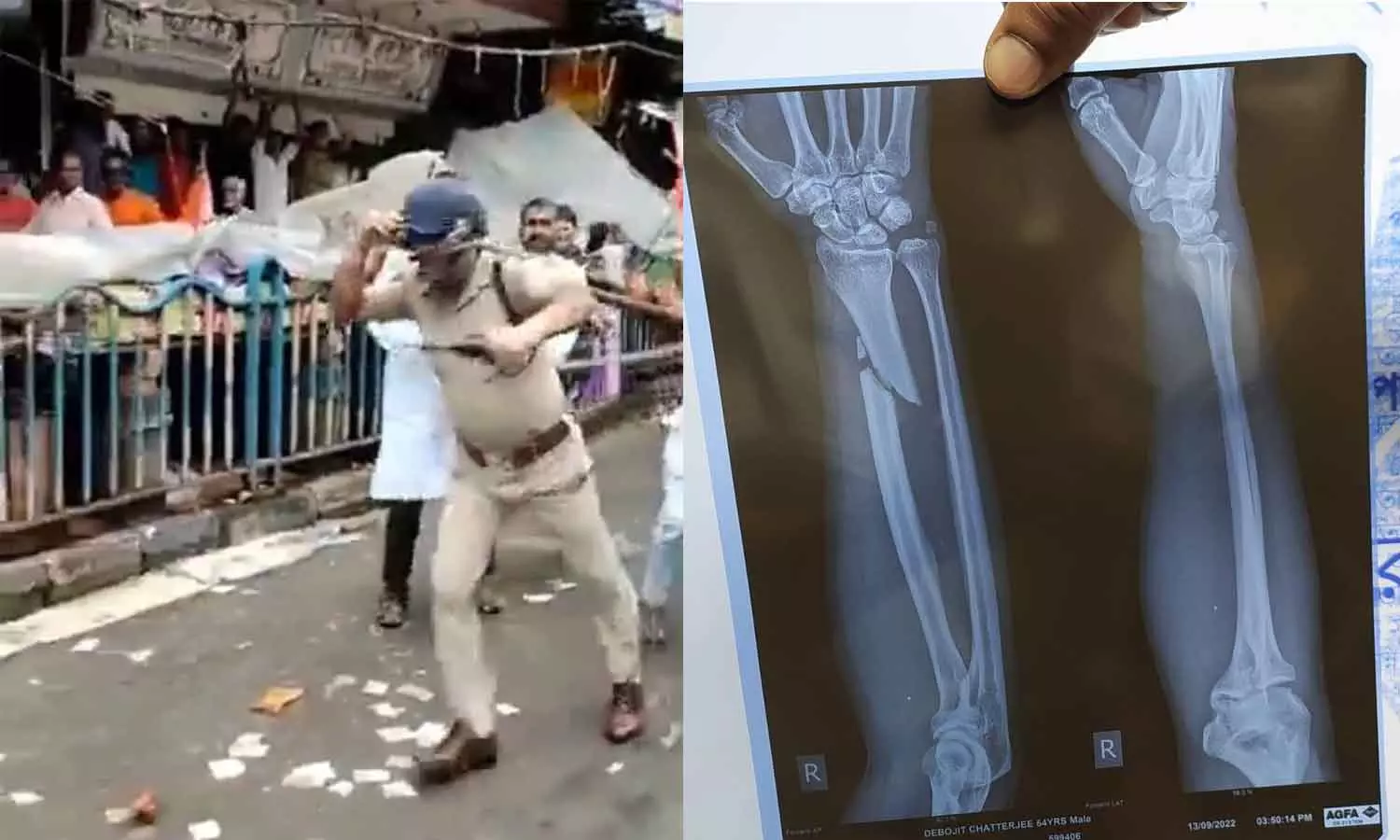 കൊൽക്കത്തയിൽ പൊലീസ് അസിസ്റ്റന്റ് കമ്മീഷണറെ വളഞ്ഞിട്ട് തല്ലി ബിജെപി പ്രവർത്തകർ