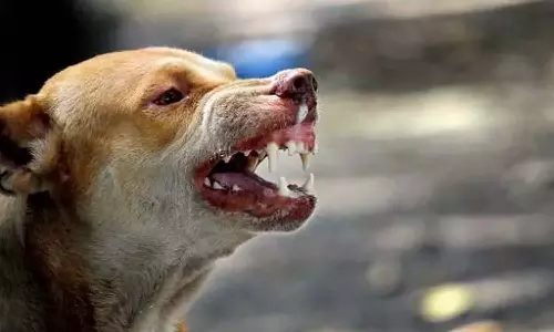 വീട്ടിലിരുന്നാലും രക്ഷയില്ല; തെരുവുനായ കടിച്ച് വീട്ടമ്മക്ക് പരിക്ക്