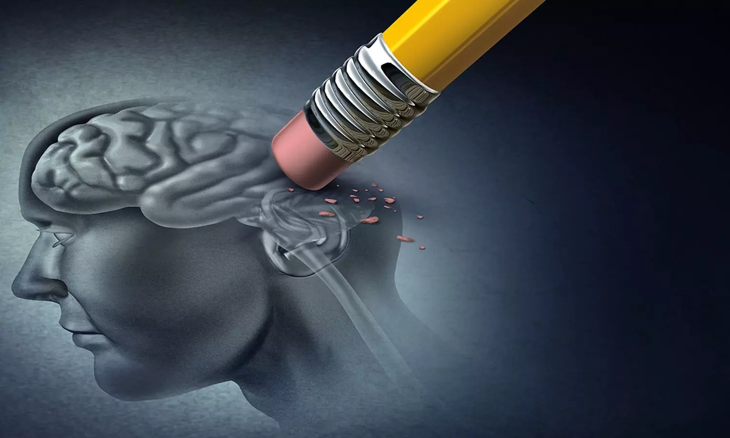 സെപ്തംബര്‍ 21 ലോക അല്‍ഷിമേഴ്‌സ് ദിനം; നേരത്തെ കണ്ടെത്തി ചികിത്സ തേടണം