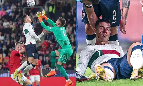 ചെക്ക് ഗോളിയുമായി കൂട്ടിയിടിച്ചു; രക്തത്തിൽ കുളിച്ച് ക്രിസ്റ്റ്യാനോ, പരിക്ക്