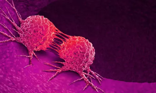 മോണയിലെ വീക്കം നിസാരമായി കാണരുത്; കാൻസറിന്റെ ലക്ഷണമാകാം മോണയിലെ വീക്കം നിസാരമായി കാണരുത്; കാൻസറിന്റെ ലക്ഷണമാകാം