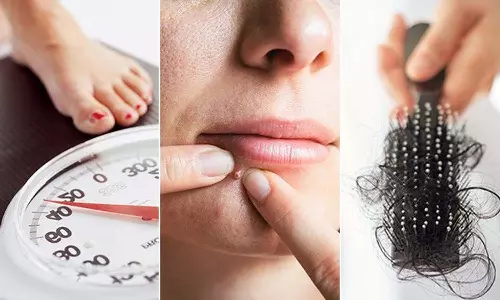 പി‌സി‌ഒ‌എസ് രോഗവും രോഗികളുടെ മാനസികാരോഗ്യവും