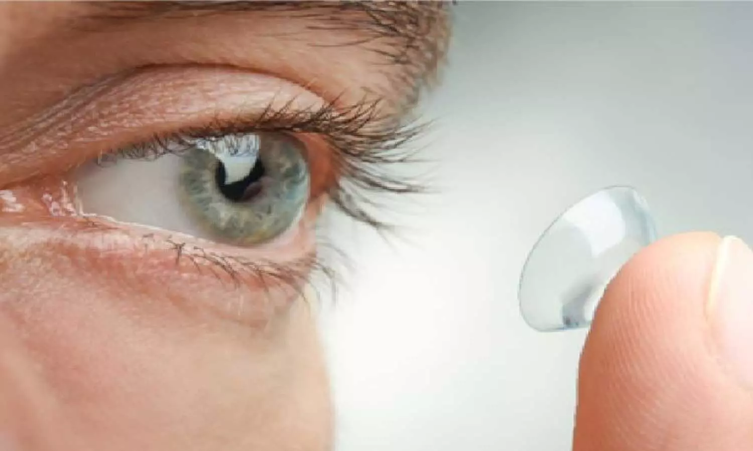 70കാരിയുടെ കണ്ണിൽ നിന്നും നീക്കം ചെയ്തത് 23 കോൺടാക്റ്റ് ലെൻസുകൾ!