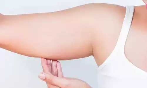 കൈവണ്ണം കുറയ്ക്കണോ? ഇതാ അഞ്ച് വഴികള്‍