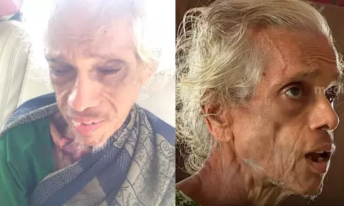 മരുമകളുടെ മർദ്ദനത്തില്‍ വൃദ്ധയുടെ കാഴ്ച നഷ്ടപ്പെട്ടു; മകനും മരുമകളും ഒളിവില്‍