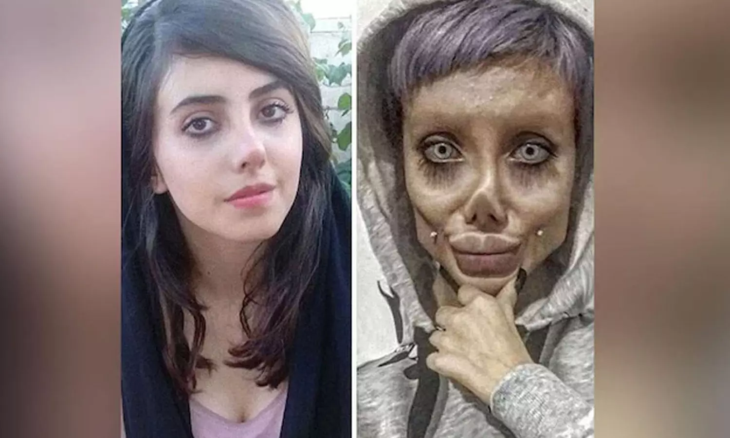 ആഞ്ജലീന ജോളിയാകാൻ വ്യാജ പ്ലാസ്റ്റിക് സർജറി; ജയിൽ മോചിതയായതോടെ മുഖം വെളിപ്പെടുത്തി ഇറാൻ യുവതി
