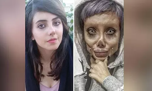 ആഞ്ജലീന ജോളിയാകാൻ വ്യാജ പ്ലാസ്റ്റിക് സർജറി; ജയിൽ മോചിതയായതോടെ മുഖം വെളിപ്പെടുത്തി ഇറാൻ യുവതി