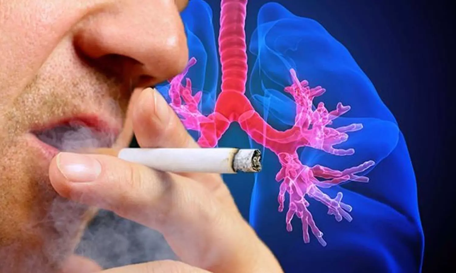 ഒരിക്കലും പുക വലിച്ചിട്ടില്ല, എന്നിട്ടും ശ്വാസകോശ കാൻസർ! എന്തു കൊണ്ടാണിത്? ഒരിക്കലും പുക വലിച്ചിട്ടില്ല, എന്നിട്ടും ശ്വാസകോശ കാൻസർ! എന്തു കൊണ്ടാണിത്?