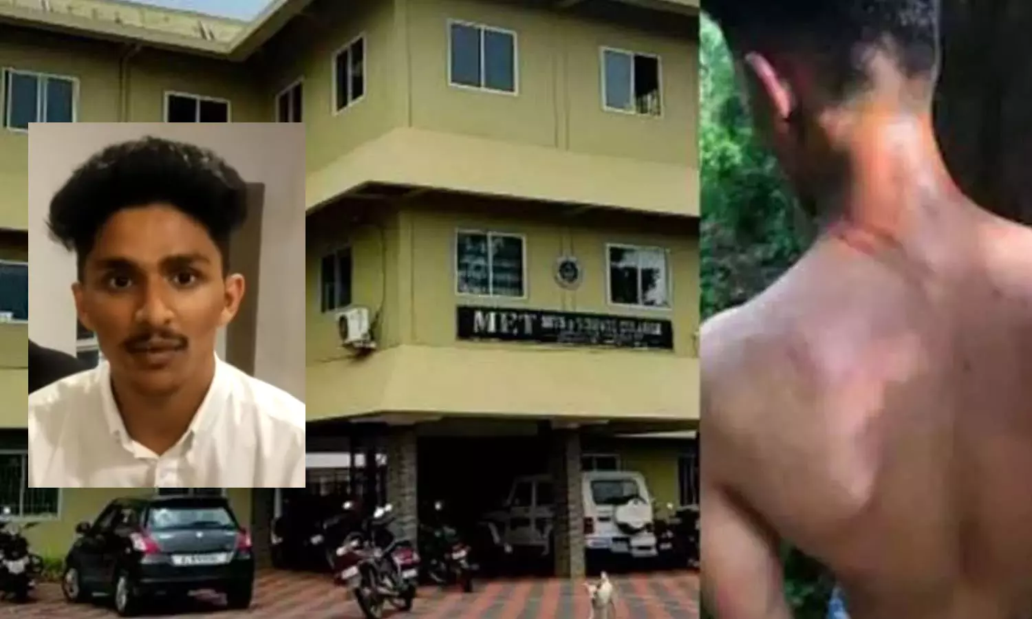 നാദാപുരം റാഗിങ്; ഒമ്പത് സീനിയർ വിദ്യാര്ഥികള്ക്കെതിരെ കേസ് നാദാപുരം റാഗിങ്; ഒമ്പത് സീനിയർ വിദ്യാര്ഥികള്ക്കെതിരെ കേസ്