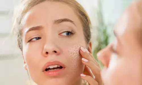 വരണ്ട ചർമ്മം മാറ്റാൻ ഓട്സിൽ കുളിക്കാം