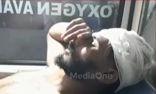 വർക്കലയിൽ റിസോർട്ട് ജീവനക്കാരനെ വിളിച്ചിറക്കി വെട്ടിപ്പരിക്കേല്‍പ്പിച്ചു