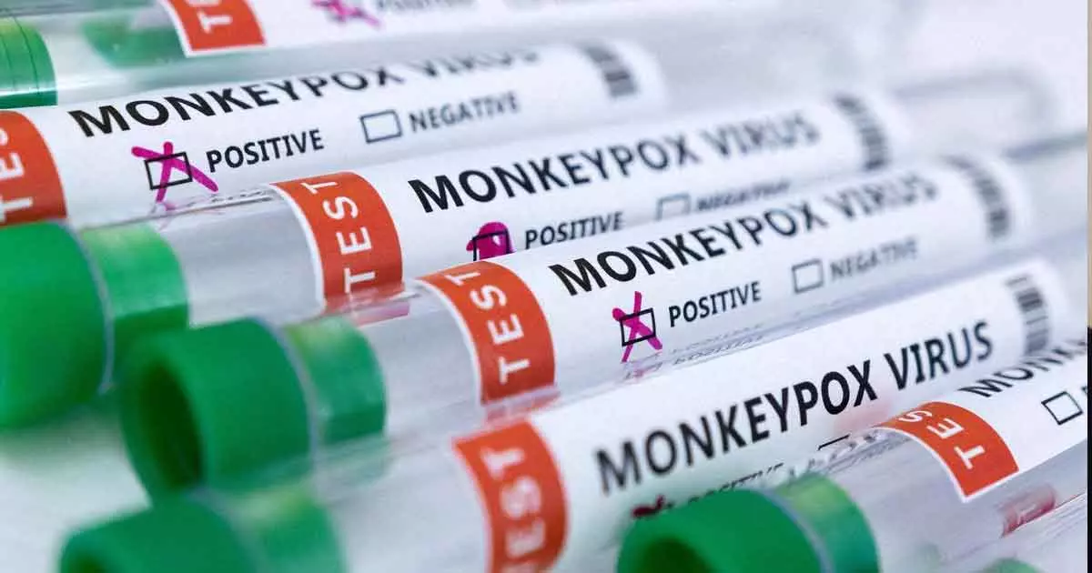 മങ്കിപോക്സിന്‍റെ പേര് മാറ്റി