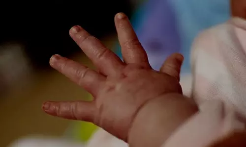 അഞ്ചാംപനി: കുട്ടികളിലെ ഈ ലക്ഷണങ്ങൾ ശ്രദ്ധിക്കണം