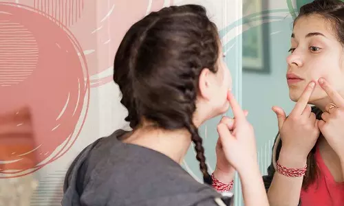 മുഖക്കുരുപ്പേടി വേണ്ട; കൗമാരക്കാർ അറിയാൻ ഇതാ മൂന്ന് വഴികൾ