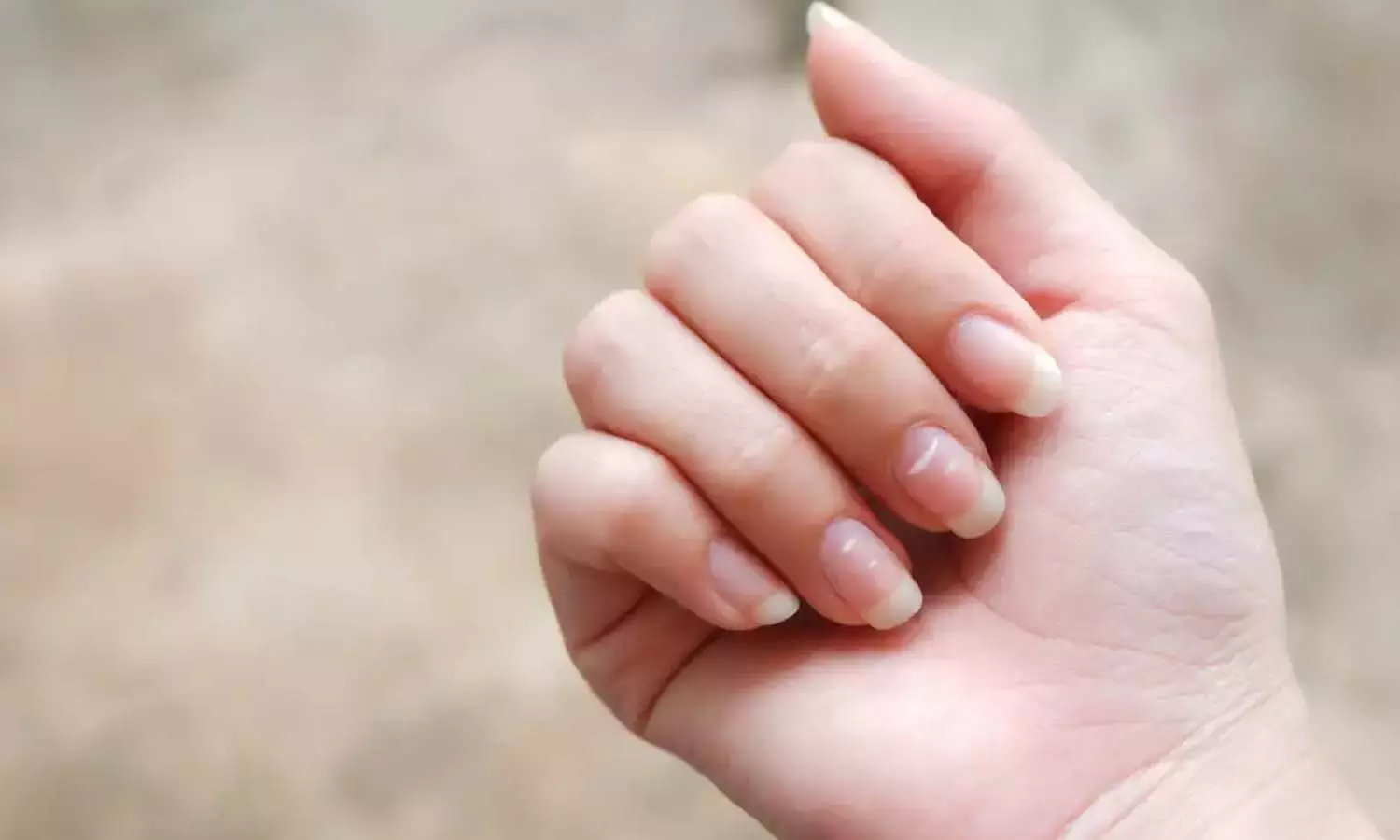 ഉറക്കക്കുറവ് മുതൽ മാനസിക സമ്മർദ്ദം വരെ; നഖത്തിലെ വെളുത്ത വരകൾ നൽകുന്ന സൂചനകൾ