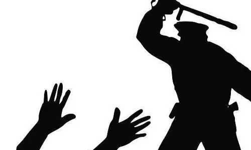 ബൂട്ടിട്ട് ചവിട്ടി,മുഖത്തടിച്ചു: ഹൃദ്രോഗിയെ സ്റ്റേഷനിൽ വിളിച്ചുവരുത്തി ഡി.വൈ.എസ്.പി മര്‍ദിച്ചെന്ന് പരാതി