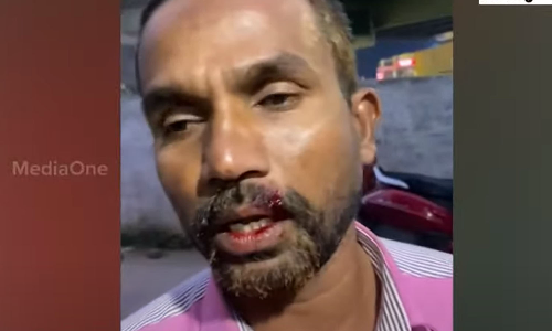 ചായ കുടിക്കാനെത്തിയ ഗൃഹനാഥനും മകനും നേരെ തട്ടുകട ഉടമയുടെ ആക്രമണം