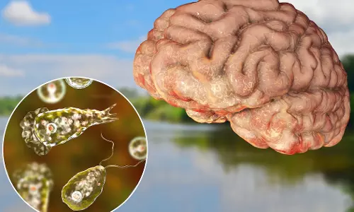 തലച്ചോര്‍ തിന്നുന്ന അമീബ; ദക്ഷിണ കൊറിയയില്‍ പുതിയ രോഗം, ആദ്യ മരണം റിപ്പോര്‍ട്ട് ചെയ്തു