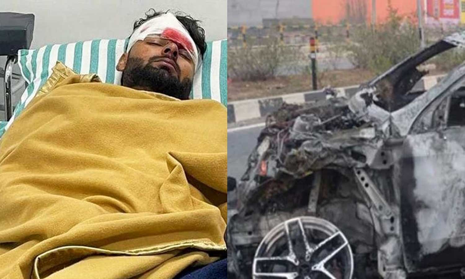 വാഹനാപകടത്തില് പരിക്കേറ്റ ഋഷഭ് പന്തിനെ പ്ലാസ്റ്റിക്ക് സര്ജറിക്ക് വിധേയനാക്കി വാഹനാപകടത്തില് പരിക്കേറ്റ ഋഷഭ് പന്തിനെ പ്ലാസ്റ്റിക്ക് സര്ജറിക്ക് വിധേയനാക്കി