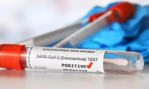 ചൈനയില്‍ നിന്നും വരുന്നവര്‍ കോവിഡ് നെഗറ്റീവ് സര്‍ട്ടിഫിക്കറ്റ് കാണിക്കണം; യാത്രാ നയത്തില്‍ മാറ്റം വരുത്തി ഖത്തര്‍