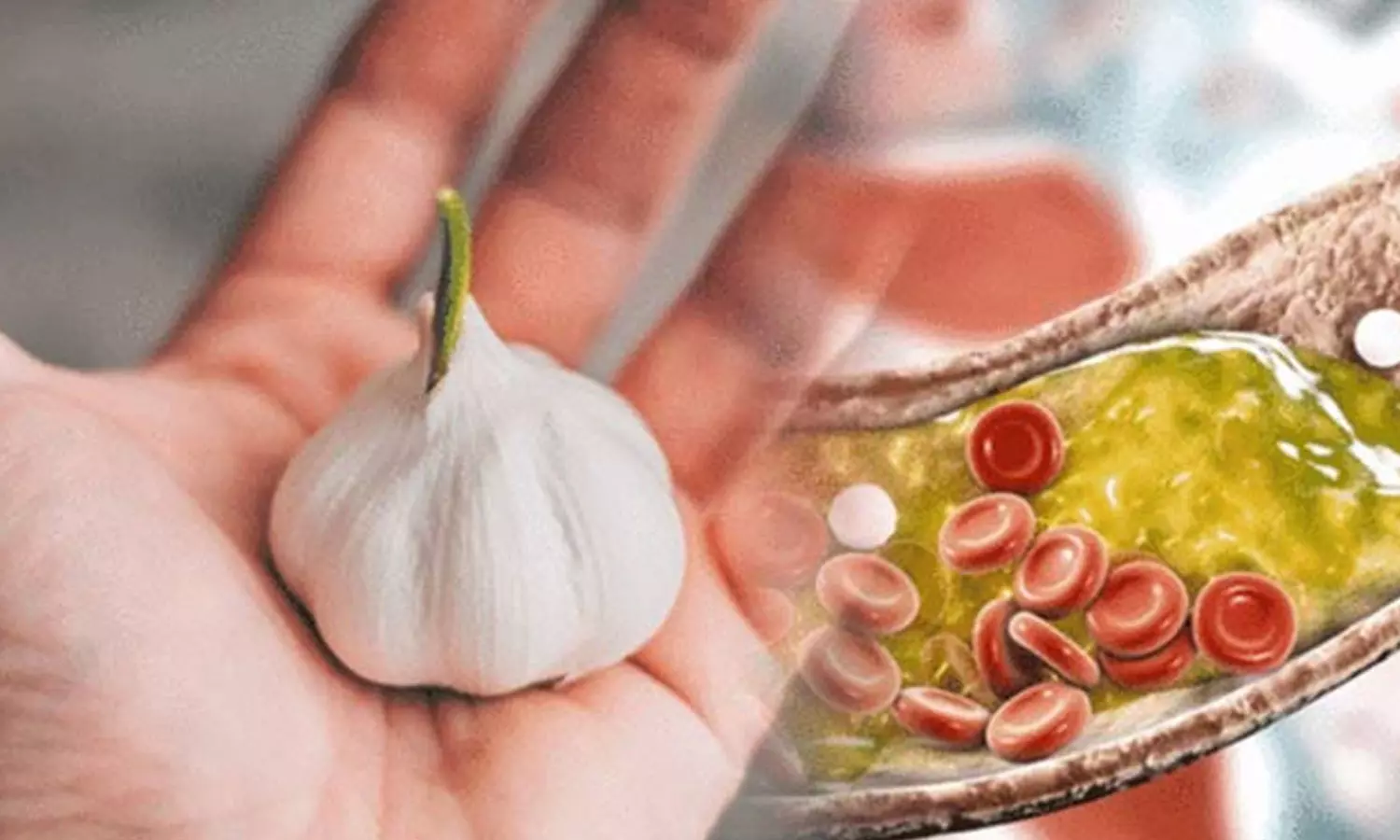 കൊളസ്ട്രോൾ കൂടുതലാണോ? വെളുത്തുള്ളിയെ കൂട്ടുപിടിച്ചോളൂ... കൊളസ്ട്രോൾ കൂടുതലാണോ? വെളുത്തുള്ളിയെ കൂട്ടുപിടിച്ചോളൂ...