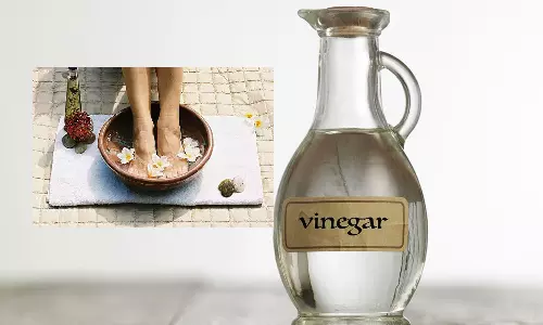 വിനാഗിരി ഉണ്ടെങ്കിൽ സോപ്പ് വേണ്ട; കാൽപാദങ്ങൾ വൃത്തിയാക്കാൻ ബെസ്റ്റാ