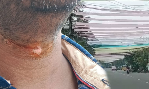 Cochin Carnival, revenue employee, കൊച്ചിന് കാര്ണിവല് Cochin Carnival, revenue employee, കൊച്ചിന് കാര്ണിവല്