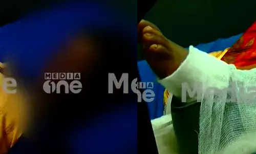 chiled attack, malapuram attack, malapuram boy