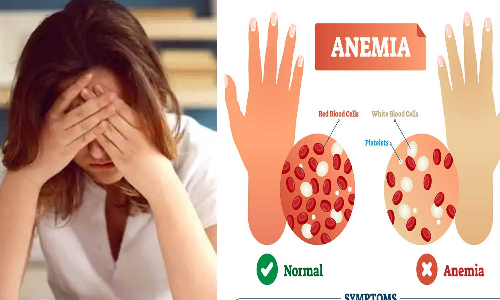 anemia, viva kerala anemia, viva kerala