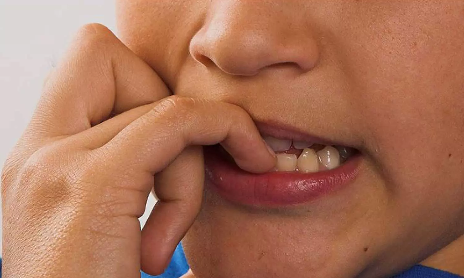 നഖം കടിക്കുന്ന ശീലം, നഖം കടിക്കല് ഗുരുതരമായ അണുബാധക്ക് കാരണമാകും,നഖം കടിക്കരുത്, നഖം കടിക്കുന്നത് കൊണ്ടുള്ള ദോഷം nail biting,paronychia,health news,biting your fingernails,How to Stop Nail Biting,nail biting habbit നഖം കടിക്കുന്ന ശീലം, നഖം കടിക്കല് ഗുരുതരമായ അണുബാധക്ക് കാരണമാകും,നഖം കടിക്കരുത്, നഖം കടിക്കുന്നത് കൊണ്ടുള്ള ദോഷം nail biting,paronychia,health news,biting your fingernails,How to Stop Nail Biting,nail biting habbit