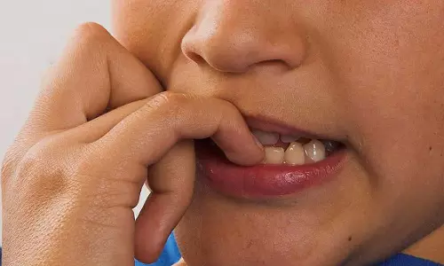 നഖം കടിക്കുന്ന ശീലം, നഖം കടിക്കല്‍ ഗുരുതരമായ അണുബാധക്ക് കാരണമാകും,നഖം കടിക്കരുത്, നഖം കടിക്കുന്നത് കൊണ്ടുള്ള ദോഷം nail biting,paronychia,health news,biting your fingernails,How to Stop Nail Biting,nail biting habbit