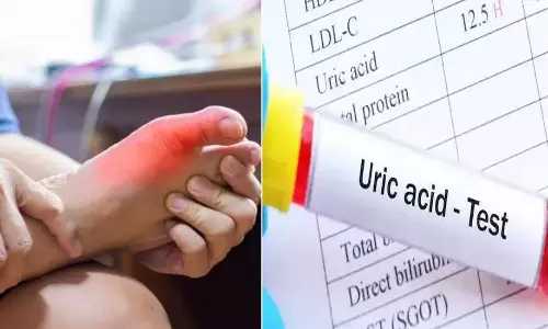 യൂറിക് ആസിഡ്,യൂറിക് ആസിഡുള്ളവര്‍ ഒഴിവാക്കേണ്ടത്, യൂറിക് ആസിഡുള്ളവര്‍ ഇതുകഴിക്കരുത് Uric Acid, Uric Acid Levels Are High,helth news