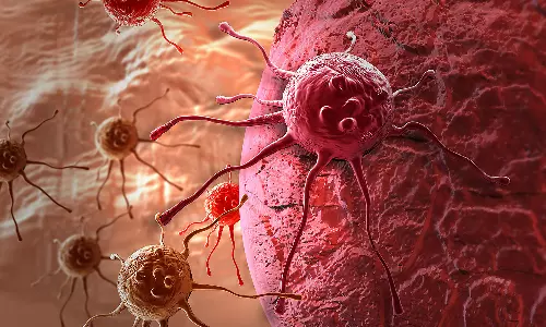 cancer, health, health news