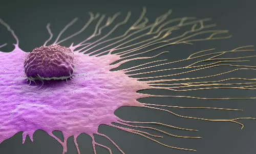 cancer, health, health news