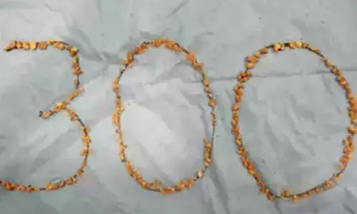 300 kidney stones removed from farmers body