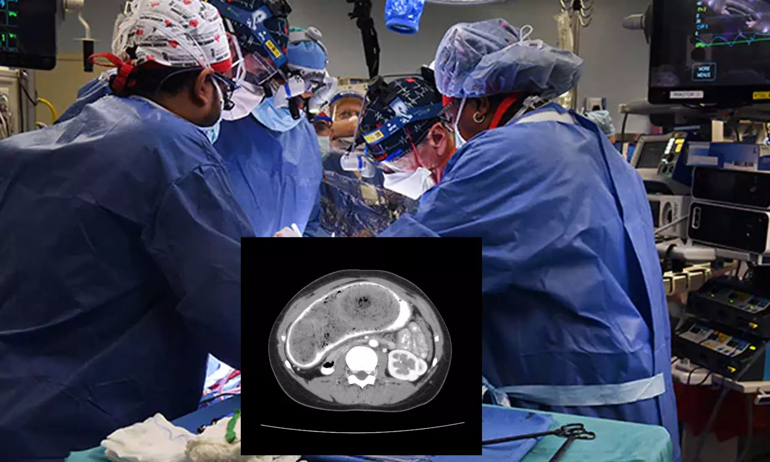 Rapunzel syndrome,Czech Republic Rapunzel syndrome,Czech Republic