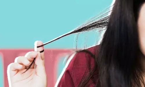 Rapunzel Syndrome, health news