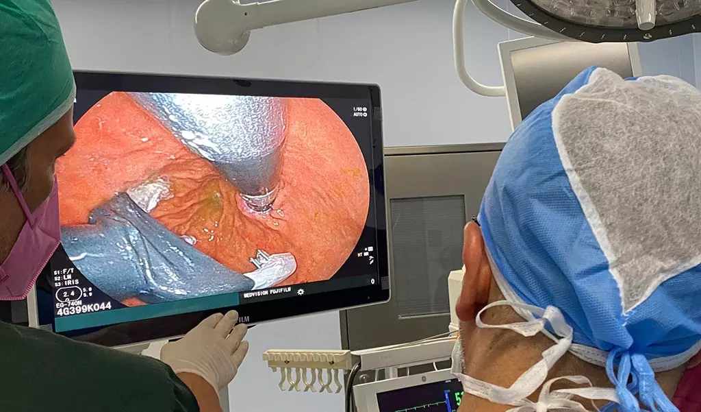 കുവൈത്തിൽ ശസ്ത്രക്രിയ കൂടാതെ ഗ്യാസ്ട്രോ   ഈസോഫാജ്യൽ റിഫ്ളക്സ് ചികിത്സ