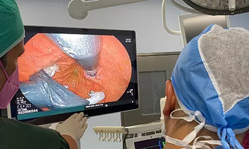 കുവൈത്തിൽ ശസ്ത്രക്രിയ കൂടാതെ ഗ്യാസ്ട്രോ   ഈസോഫാജ്യൽ റിഫ്ളക്സ് ചികിത്സ